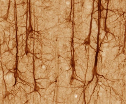 Even more neurons
